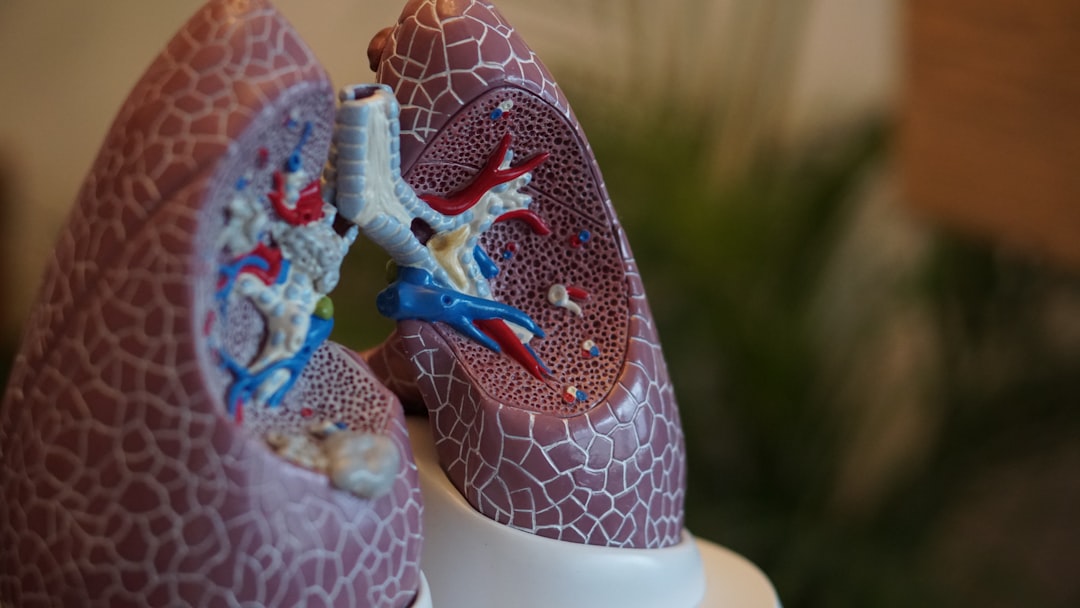 Lung cancer diagnostics